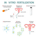 In vitro fertilization concept with steps and procedures of artificial insemination vector illustration