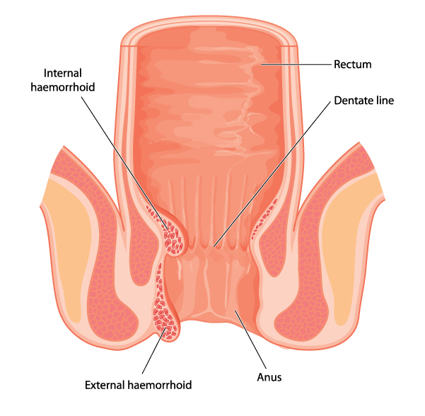 Cross,Section,Of,The,Rectum,And,Anal,Canal,,Showing,Position